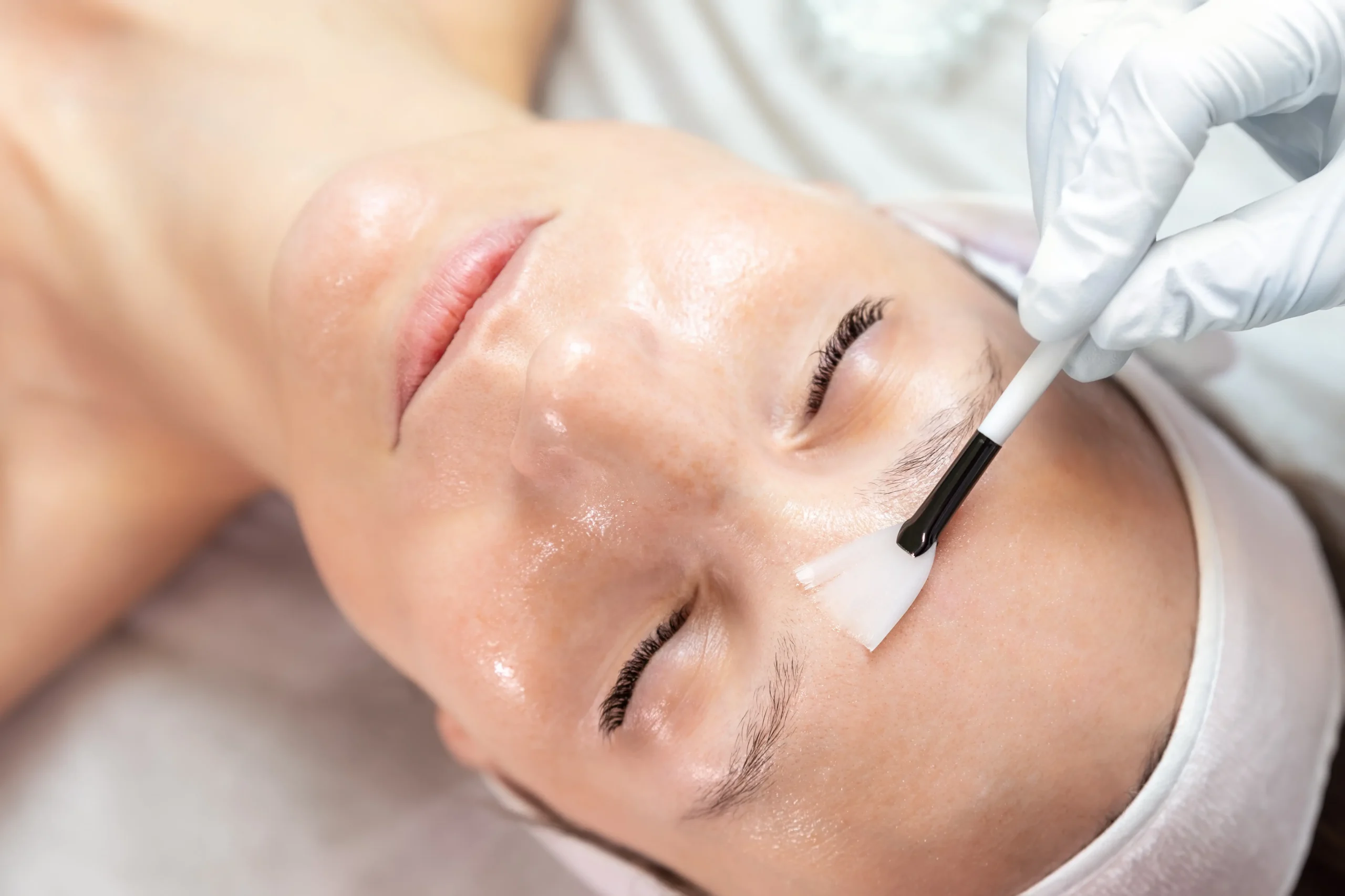 Practitioner applying a skincare solution to a woman's forehead with a brush