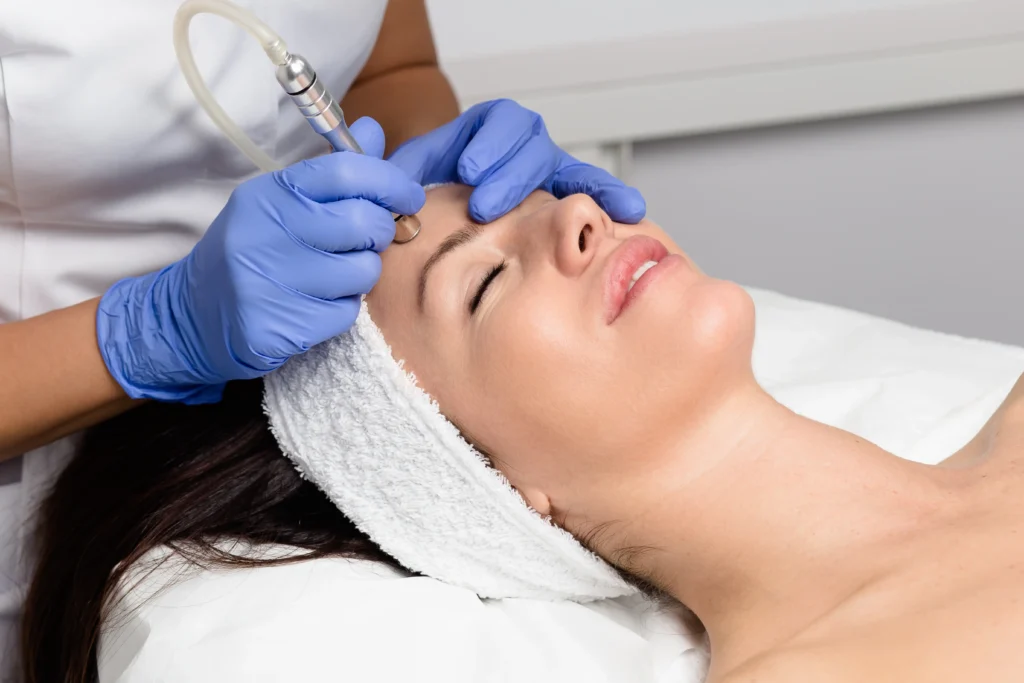 Practitioner performing a microdermabrasion facial with a handheld device on the forehead